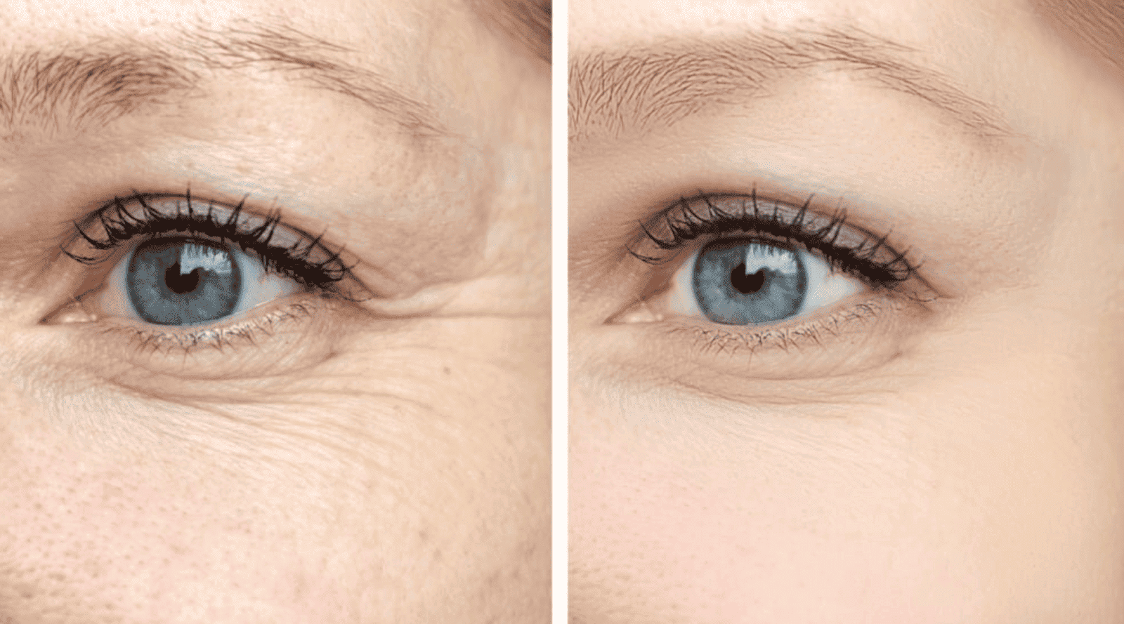 During the Procedure